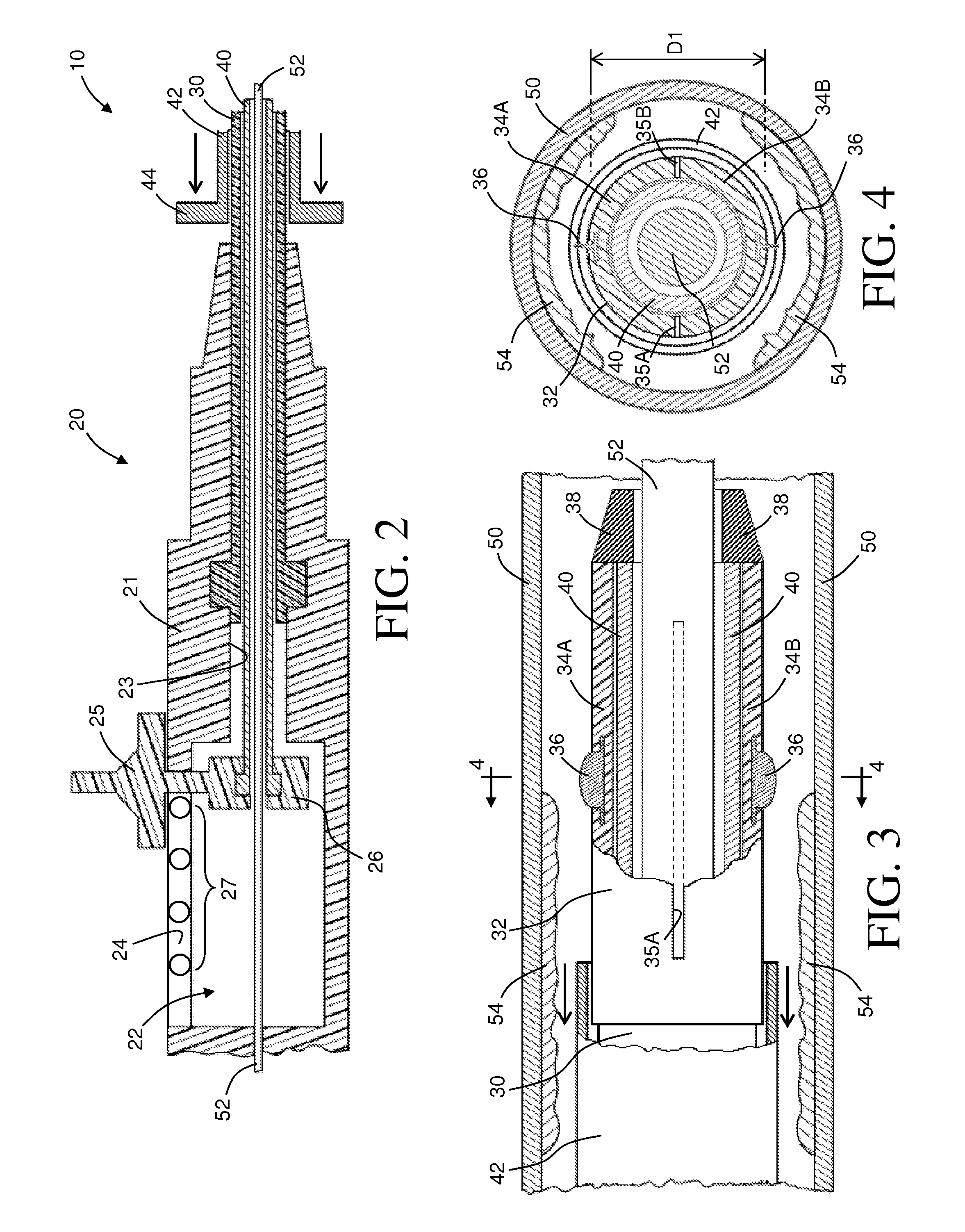 Intravascular Catheter Having An Expandable Incising Portion