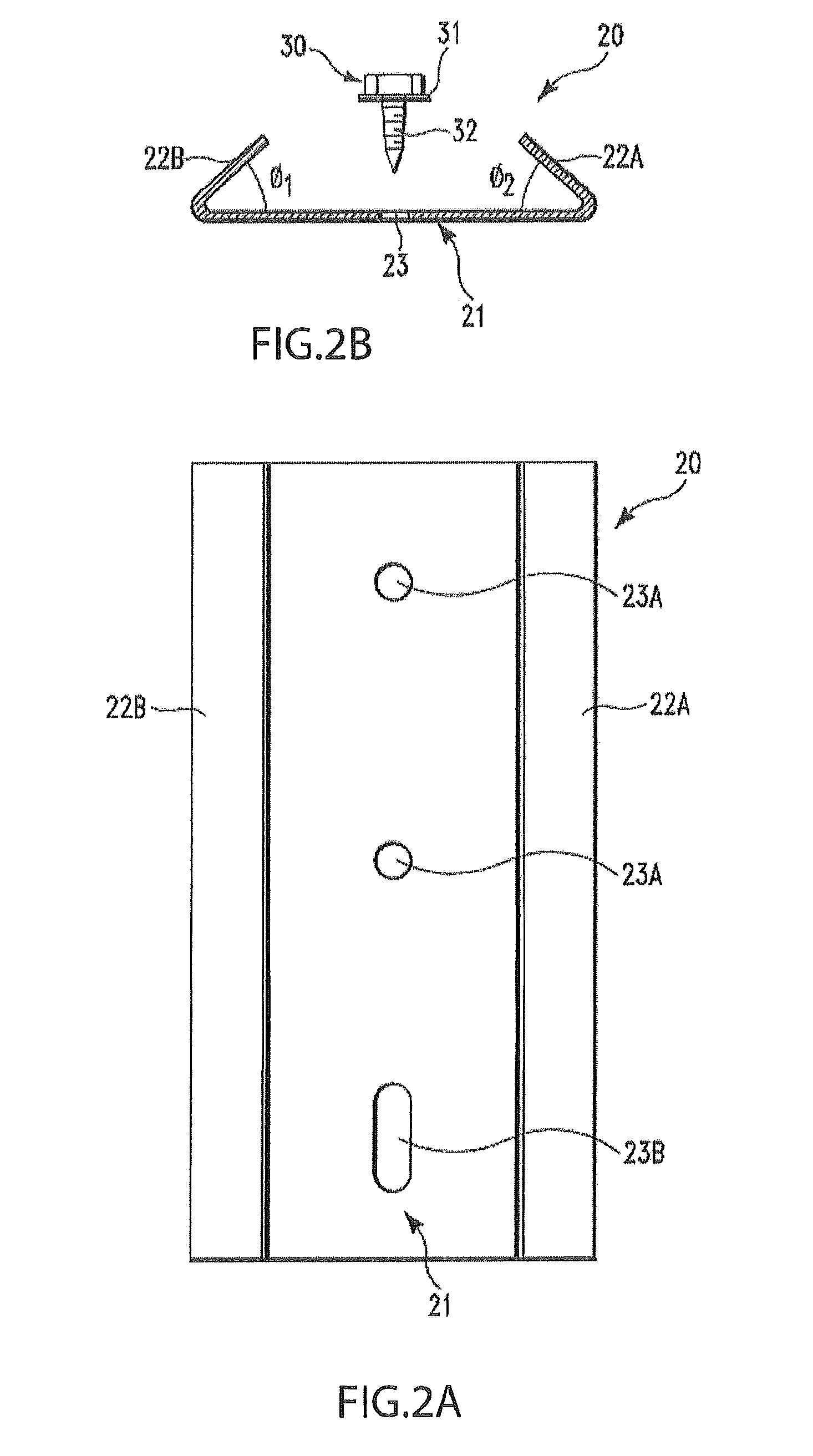 Stacking masonry block system with transition block and utility groove running therethrough