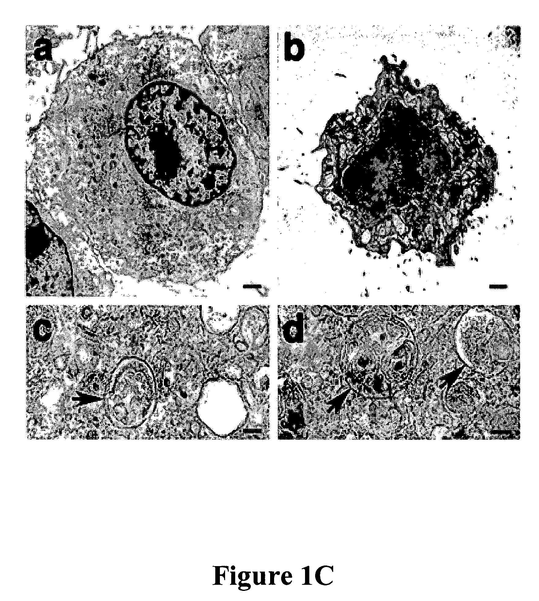 Function of autophagy genes in cell death