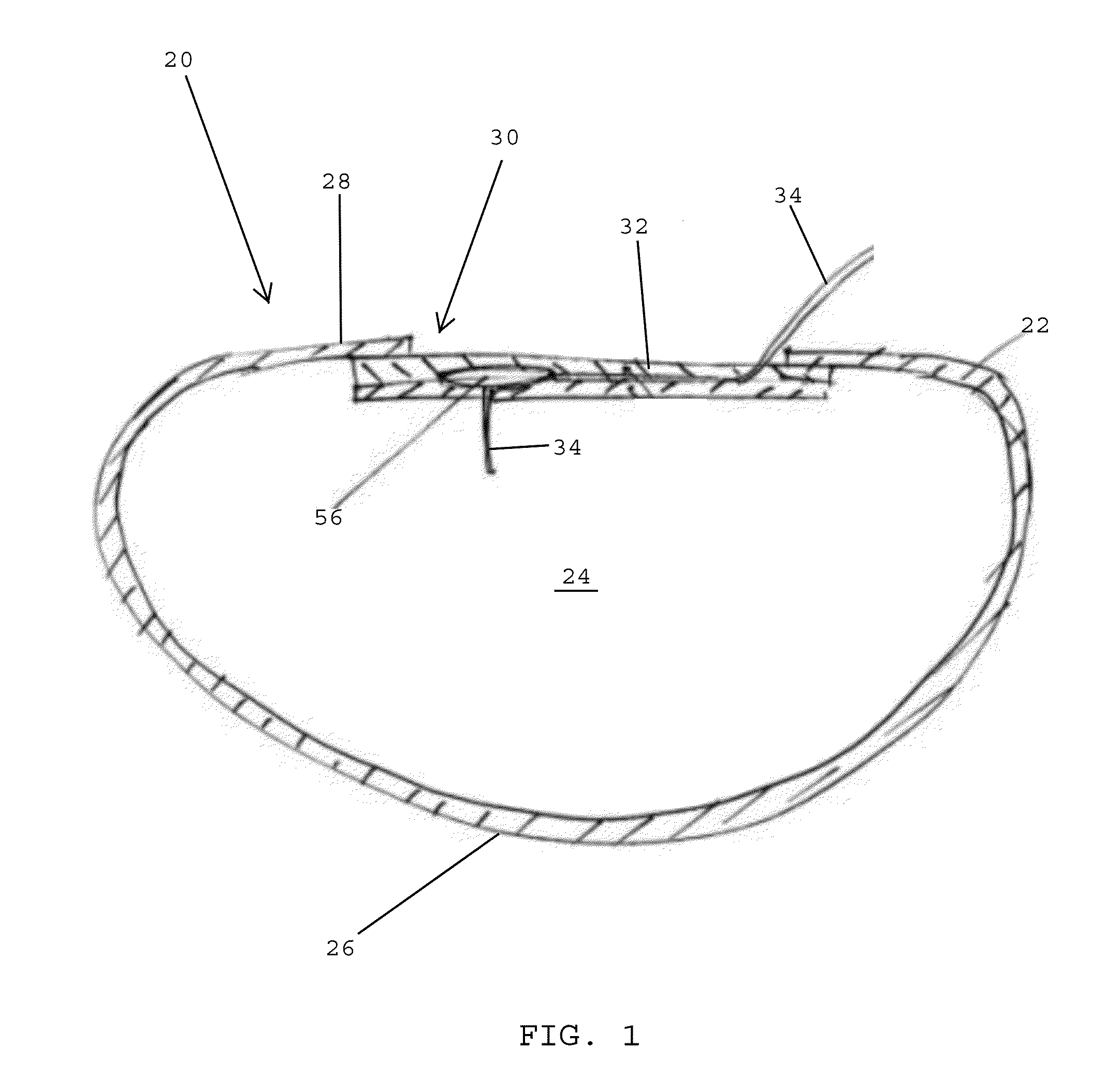 Valve assemblies for implantable prostheses and tissue expanders