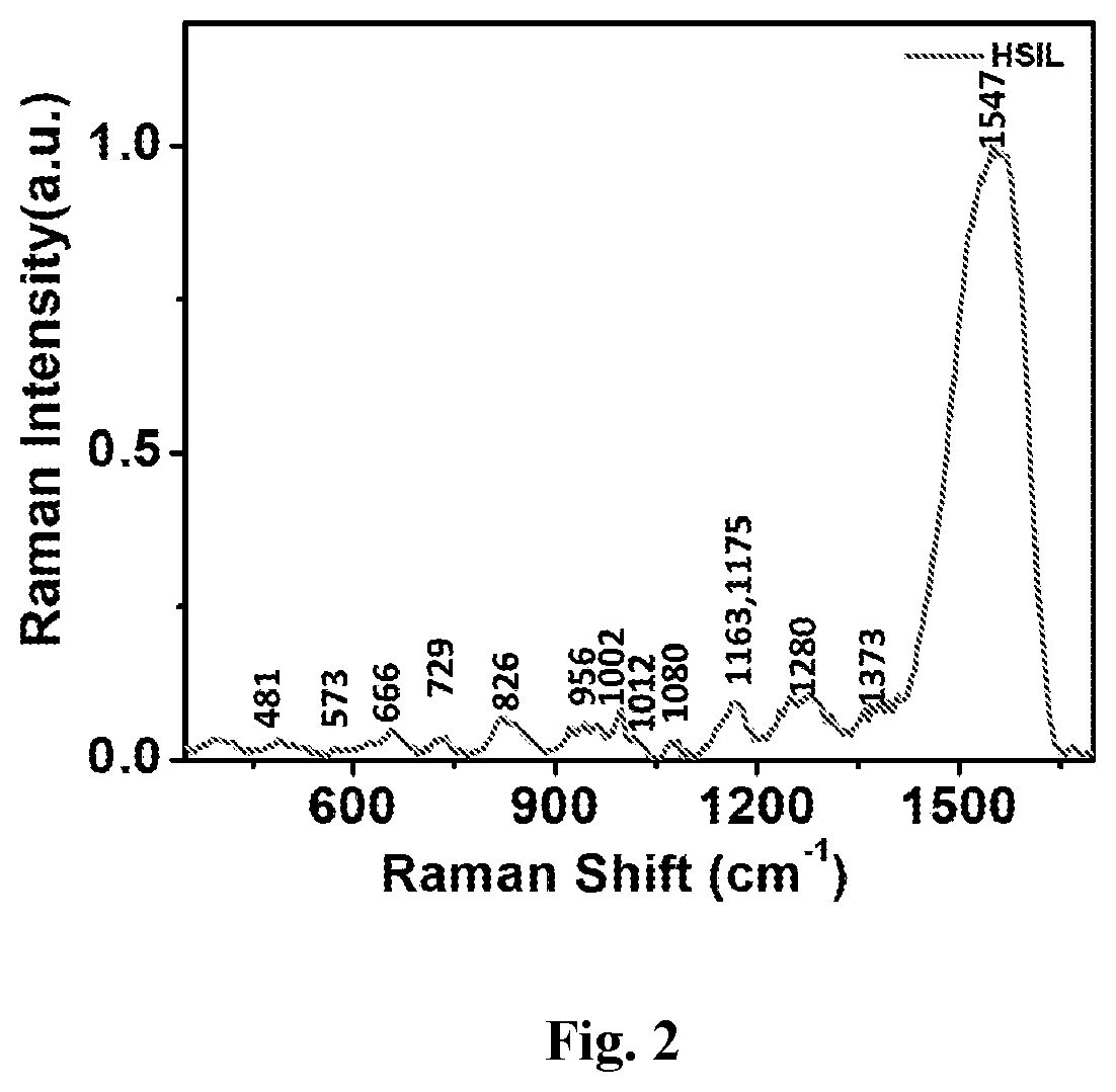 Screening kit for detection of grades of cervical cancer and process for the preparation thereof