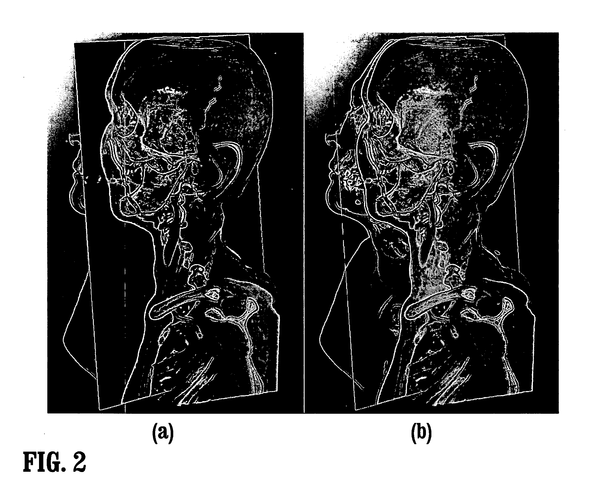 System and method for in-context mpr visualization using virtual incision volume visualization