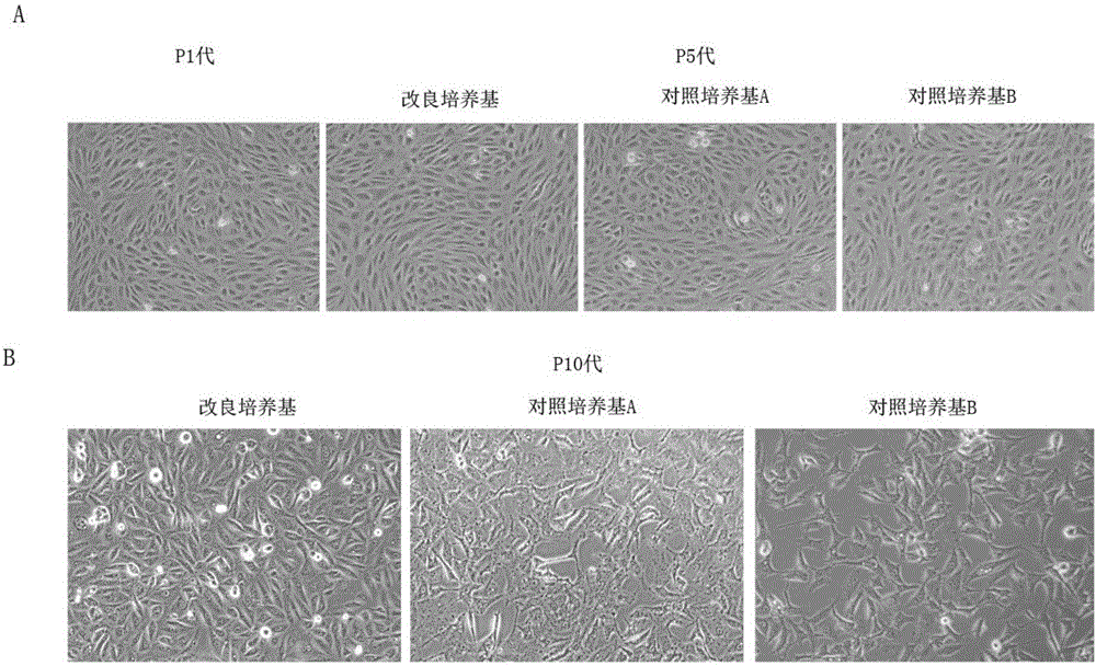 Human vascular endothelial cell culture solution and culture method