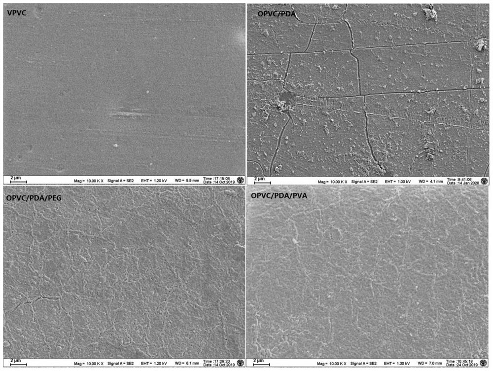 Preparation method of hydrophilic lubricating coating on surface of PVC catheter