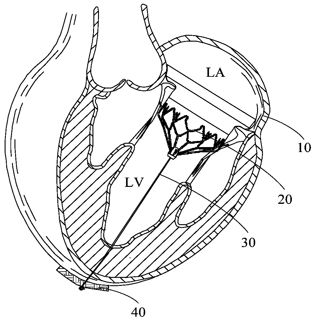Heart valve tether and heart valve assembly with same