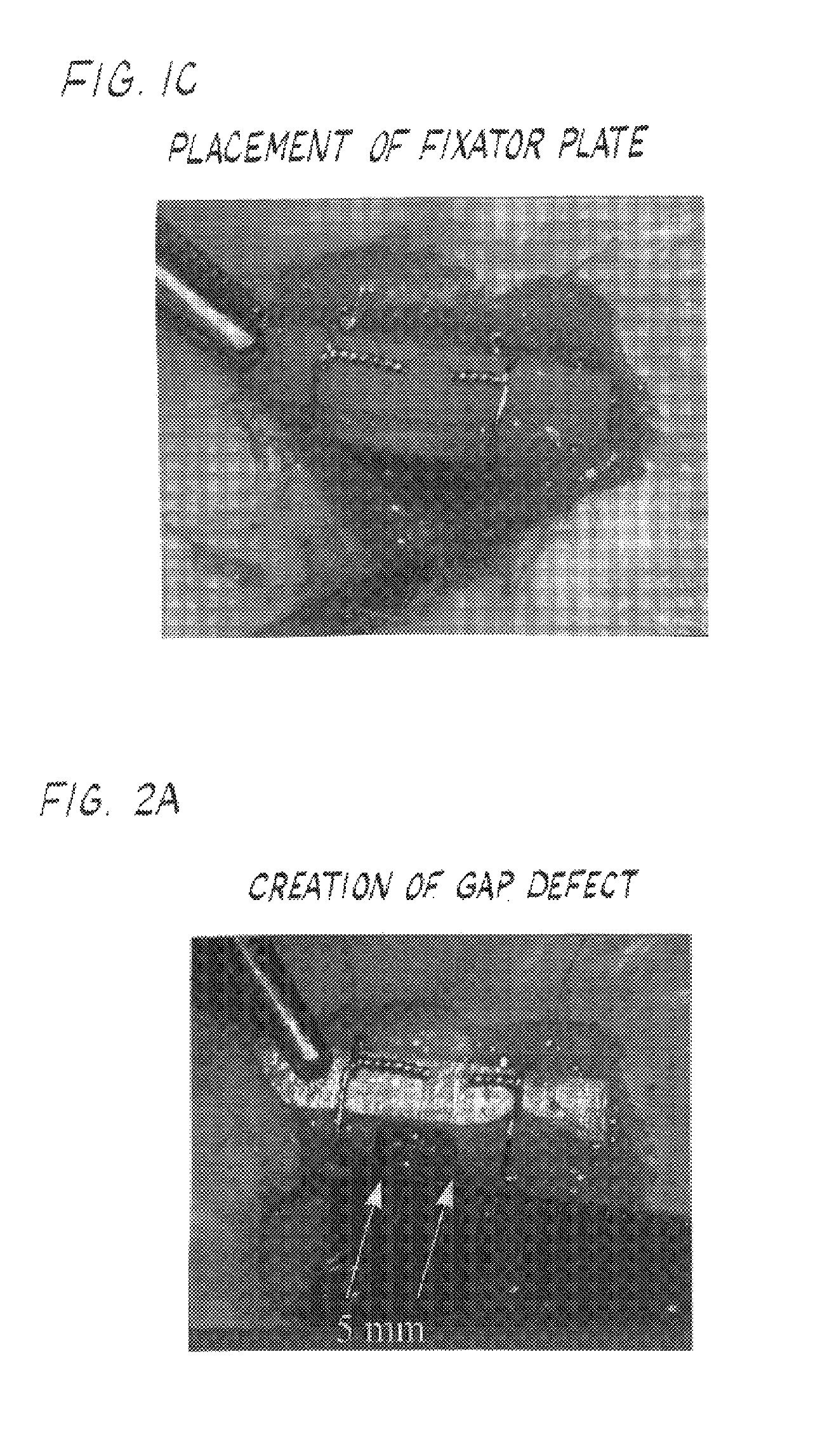 Compositions and methods for forming and strengthening bone