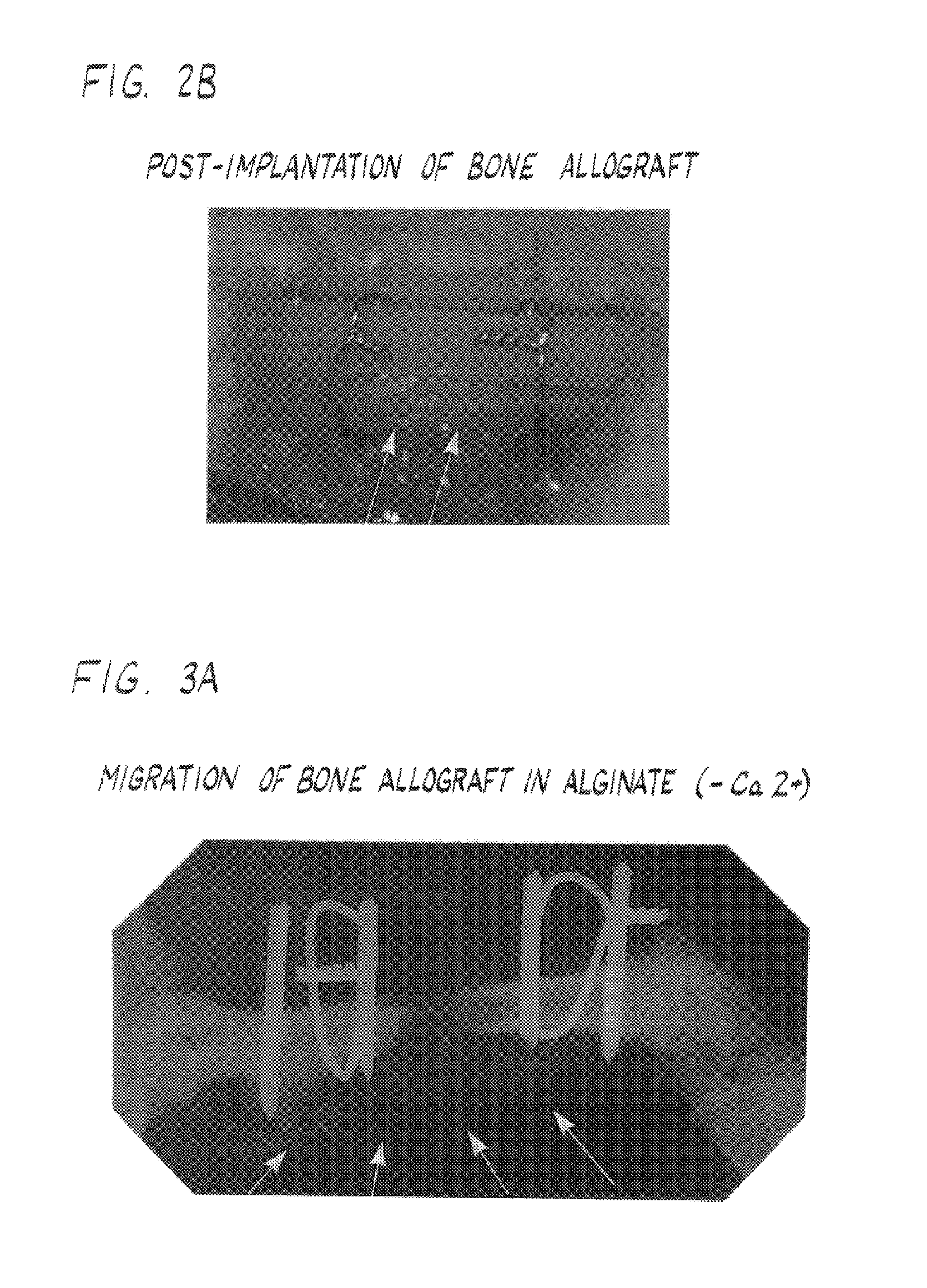Compositions and methods for forming and strengthening bone