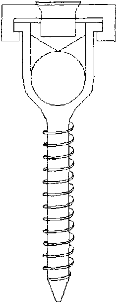 Special apparatus for correcting scoliosis deformity in growth period