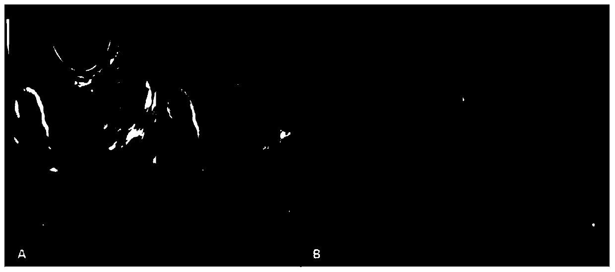 Mixed liquid of chitosan and salvia miltiorrhiza for fallopian tube obstructive infertility and application thereof