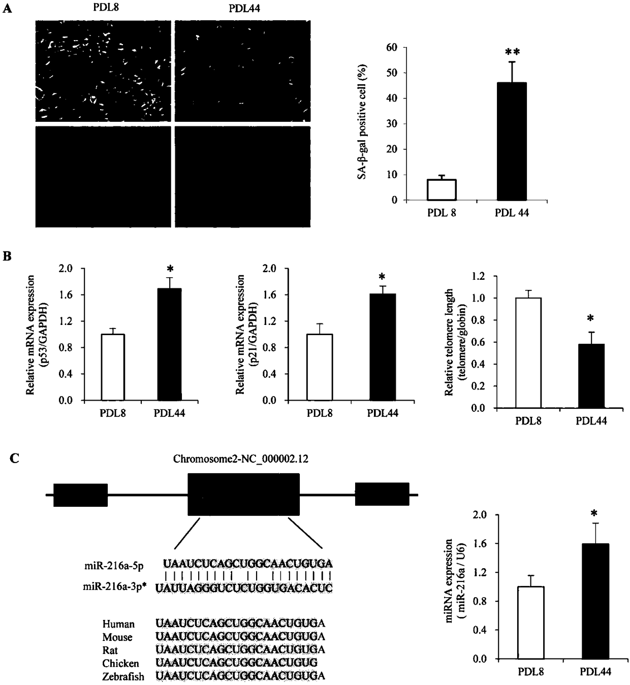 Application of miR-216a and target gene thereof in vascular senescence and atherosclerotic heart disease
