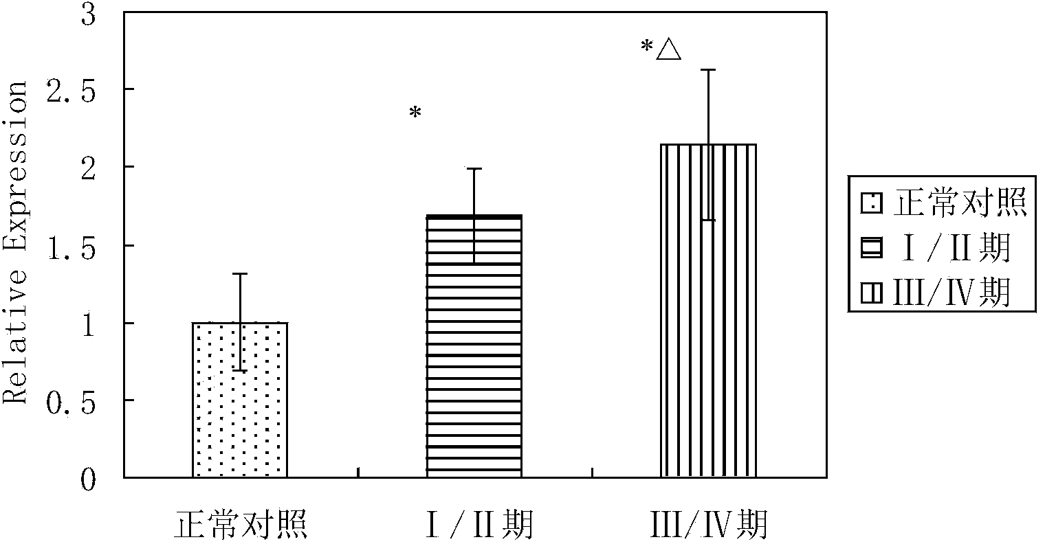 Marker for B cell non-hodgkin lymphoma and drug resistance detection thereof