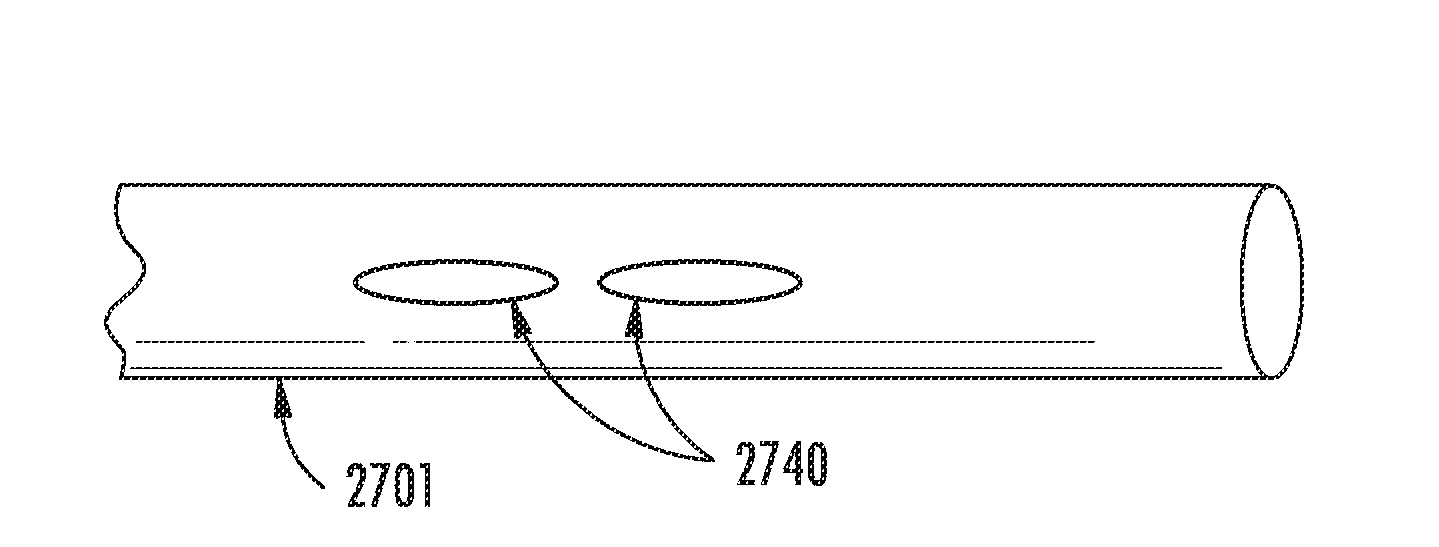 Microvalve protection device and method of use for protection against embolization agent reflux