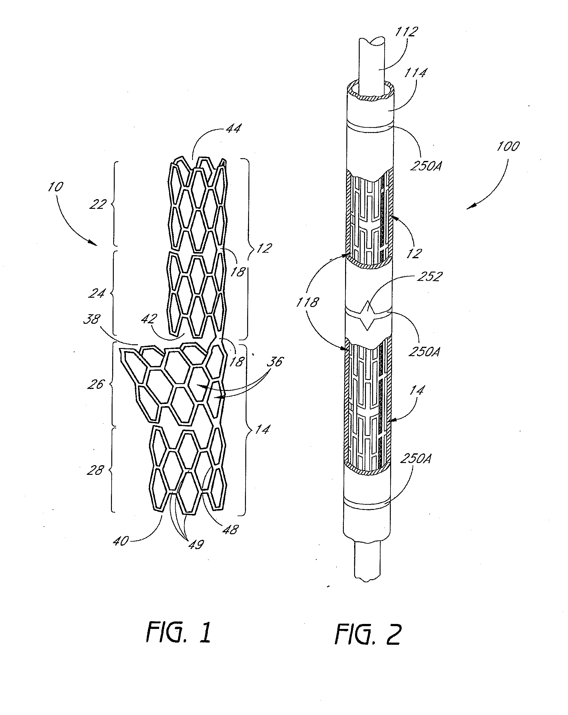 Bifurcation stent and method of positioning in a body lumen