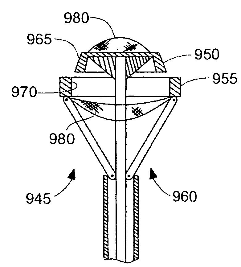 Method and apparatus for resecting and replacing an aortic valve
