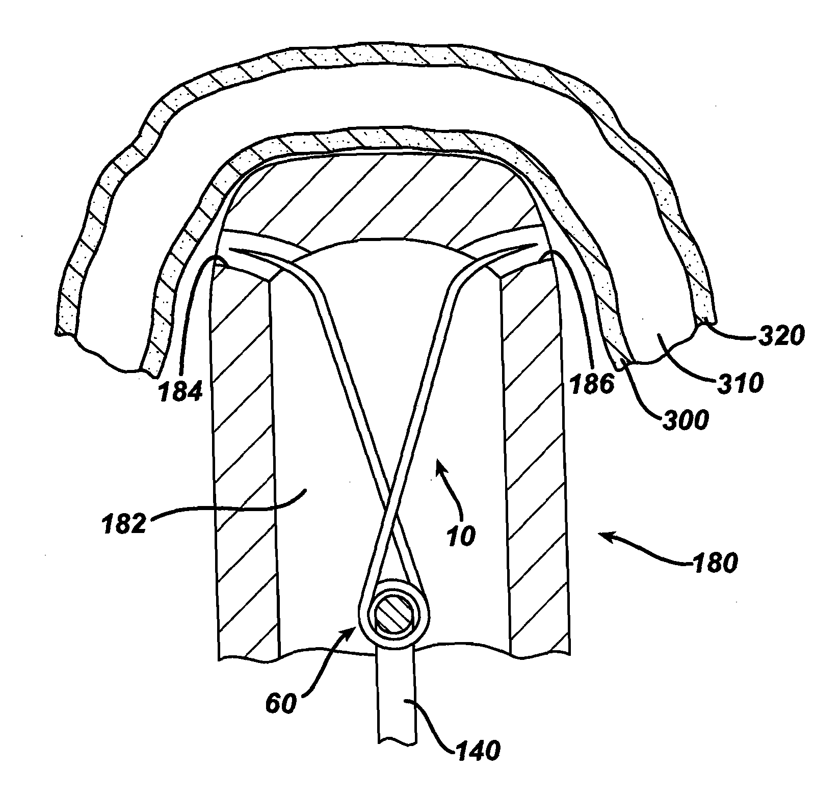 Tissue Manipulator