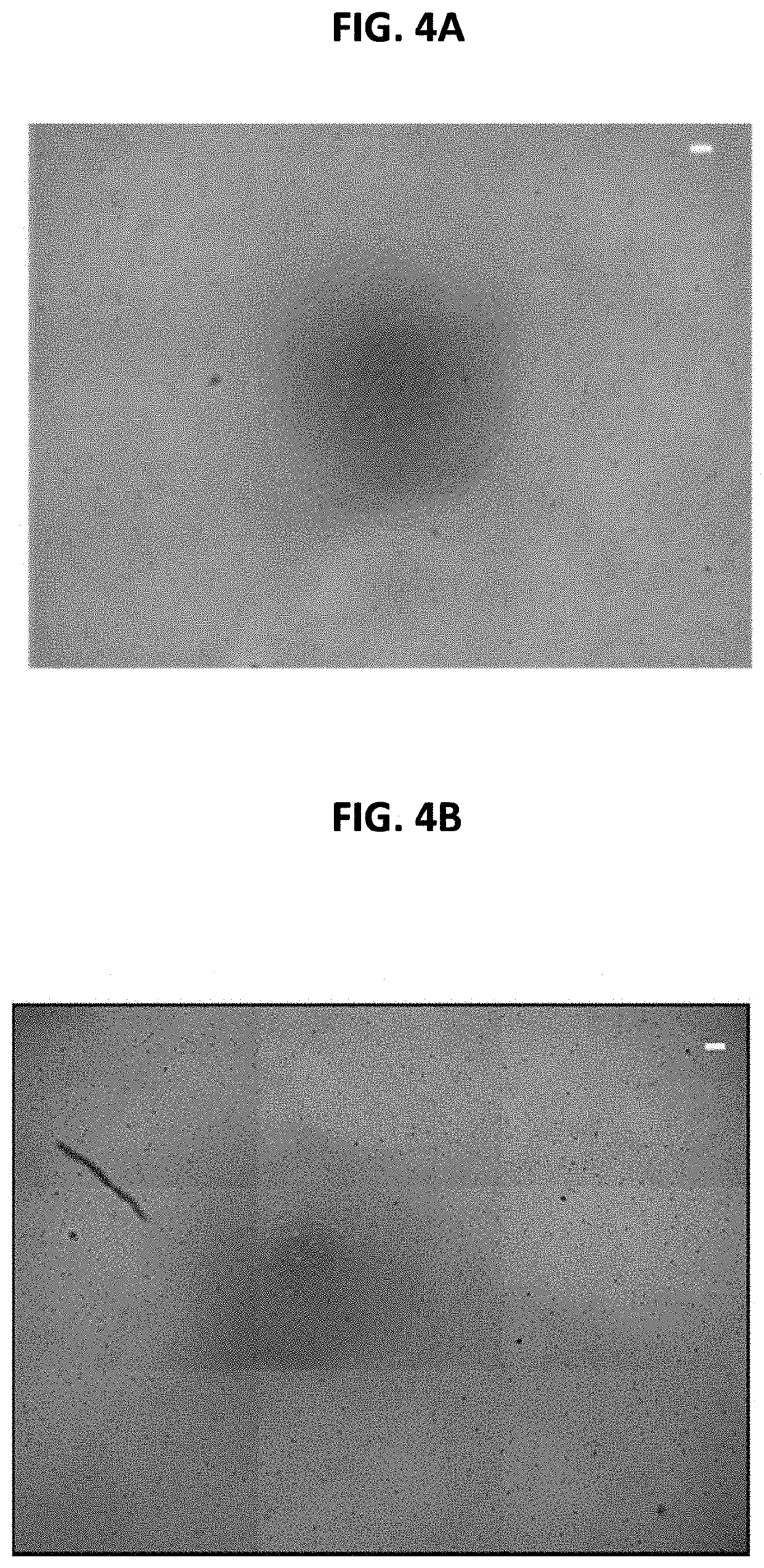 Mineral coated microparticles for co-delivery of anti-inflammatory molecules with nucleic acids to improve gene delivery outcomes