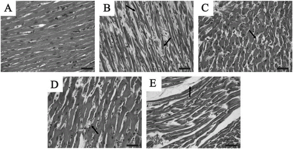 Application of tannic acid to preparation of cardiac hypertrophy antagonist