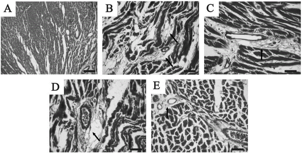 Application of tannic acid to preparation of cardiac hypertrophy antagonist