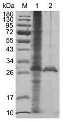 A kind of chitosanase csnq and its application