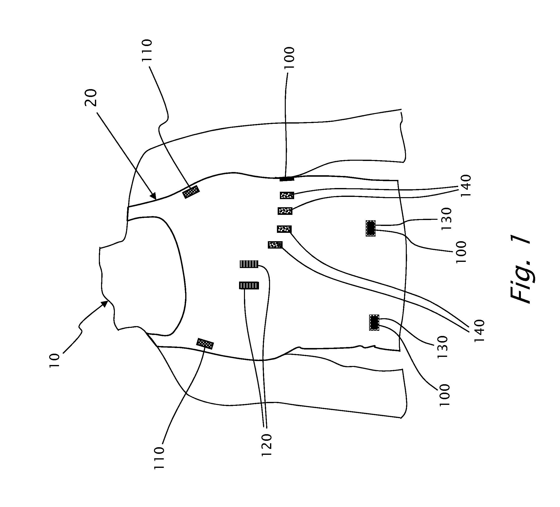 Method for limiting elasticity of selected regions in knitted fabrics