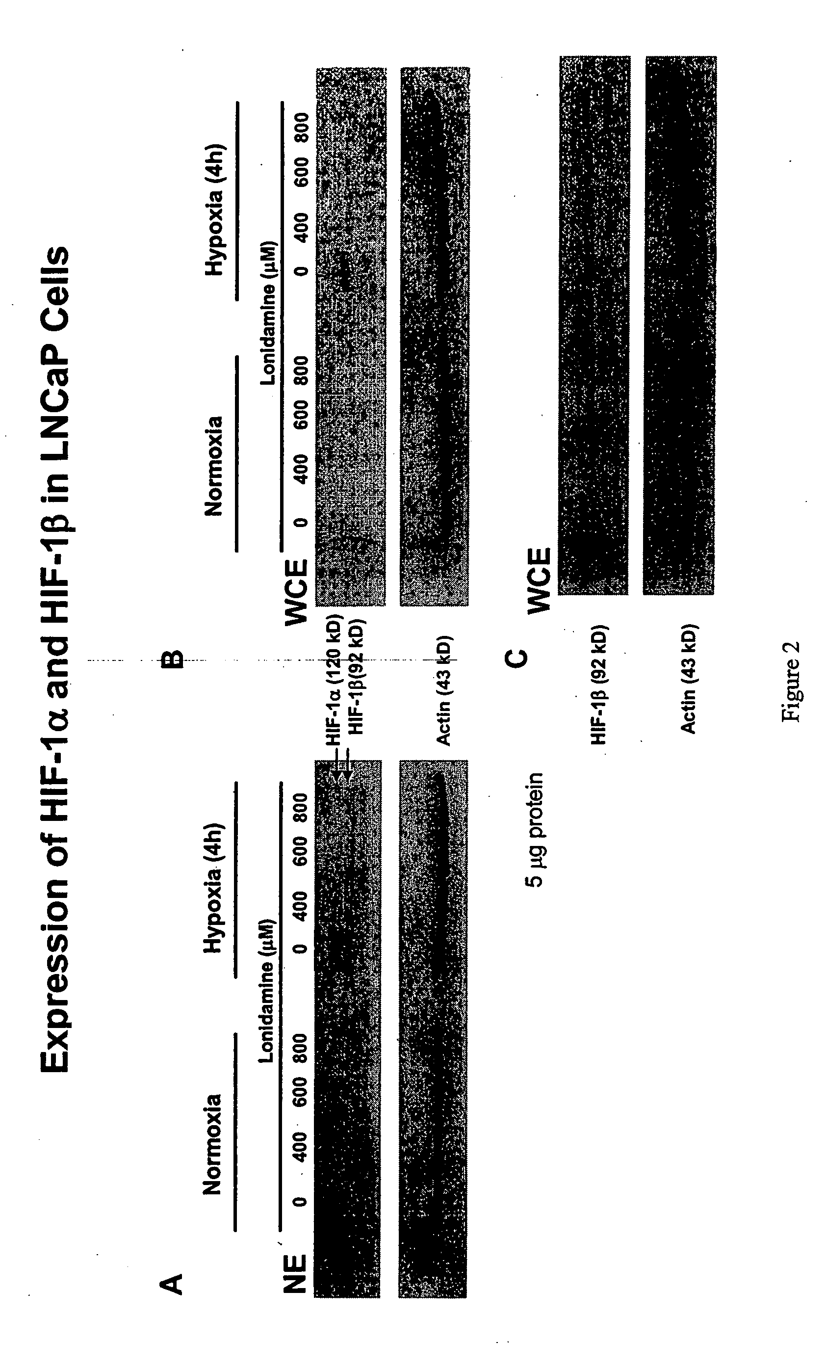 Prevention and treatment of benign prostatic hyperplasia