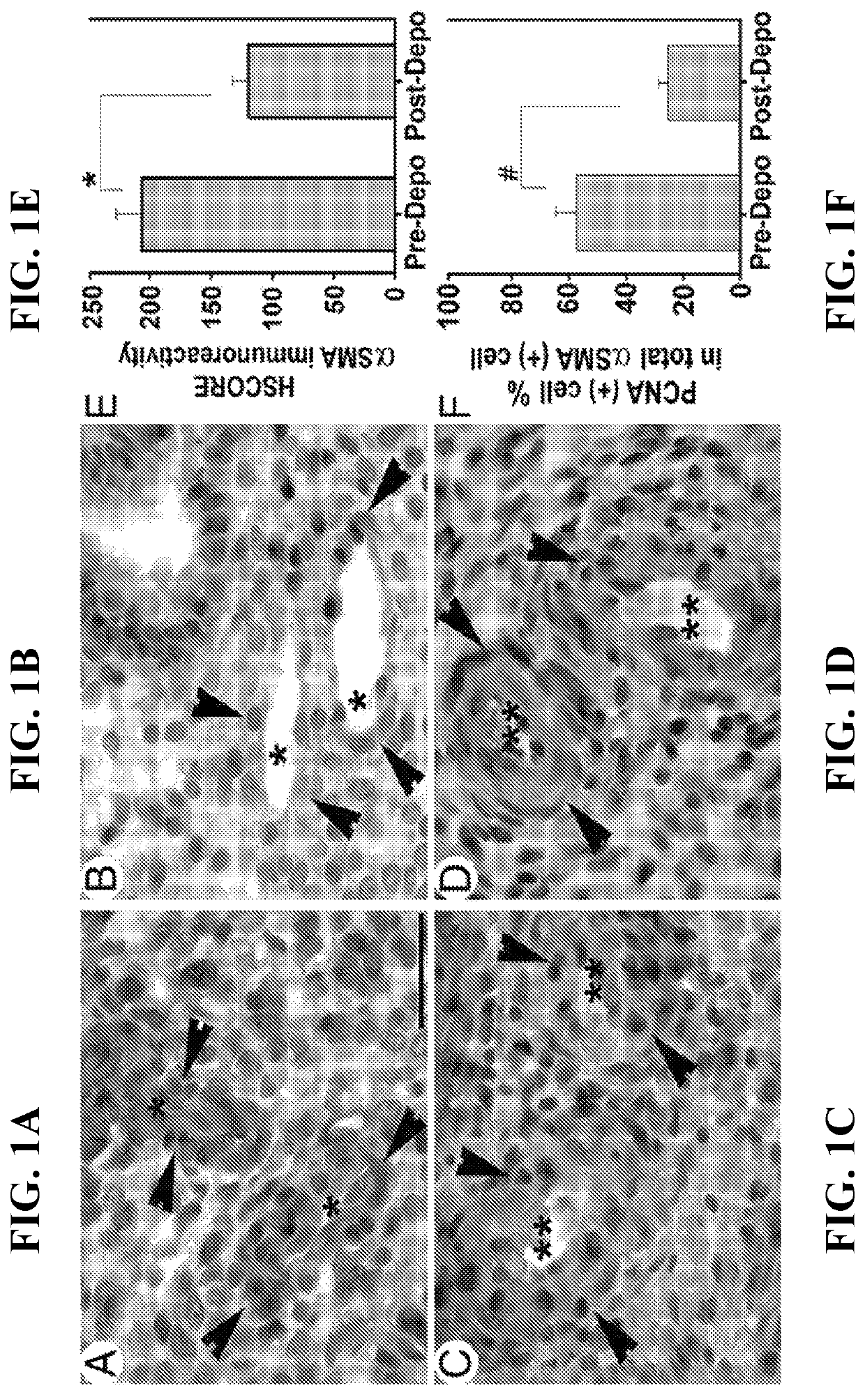 Use of CCL2 to inhibit abnormal uterine bleeding