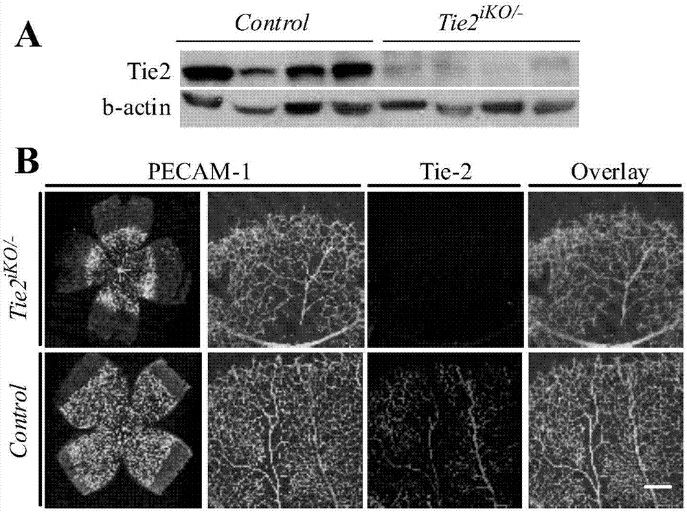 Protective effect of Tie2 on retina and vein vessels in other tissues and application of Tie2