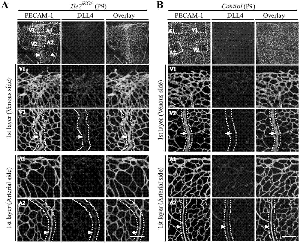 Protective effect of Tie2 on retina and vein vessels in other tissues and application of Tie2