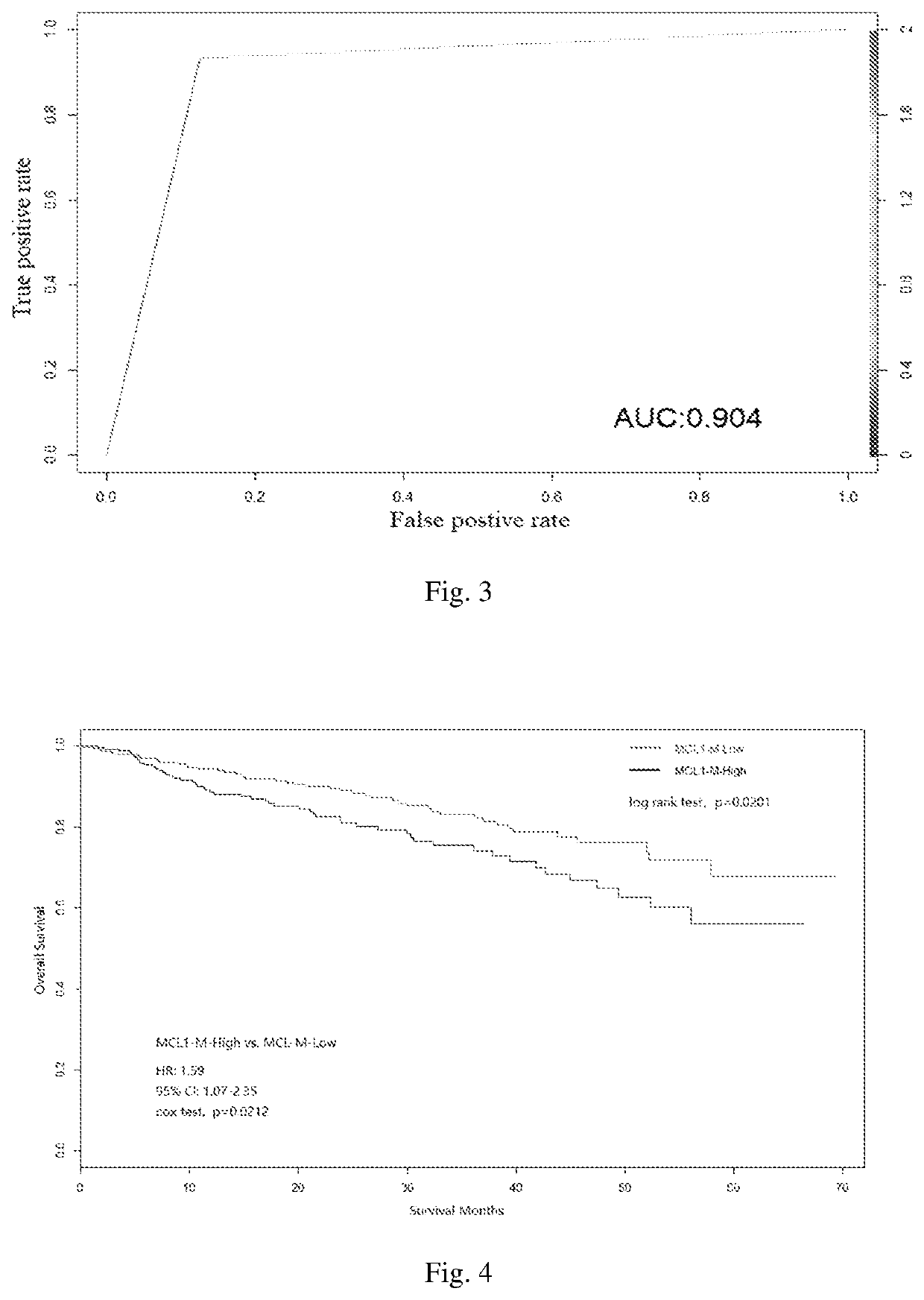 Molecular typing of multiple myeloma and application