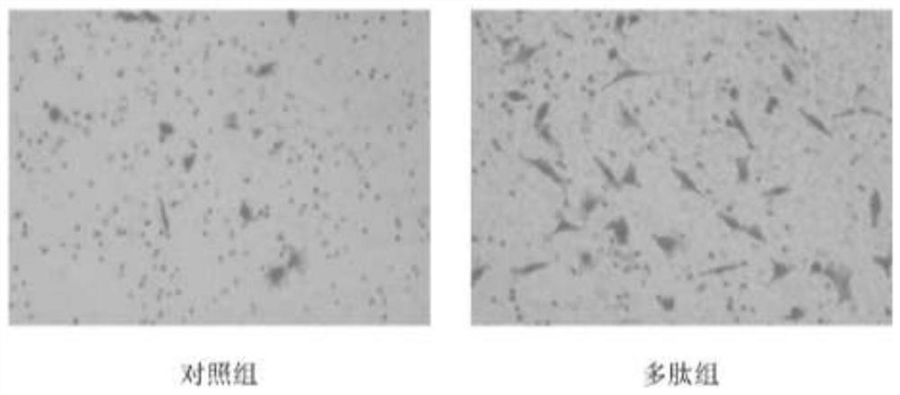 Placenta-derived endogenous polypeptide and application thereof