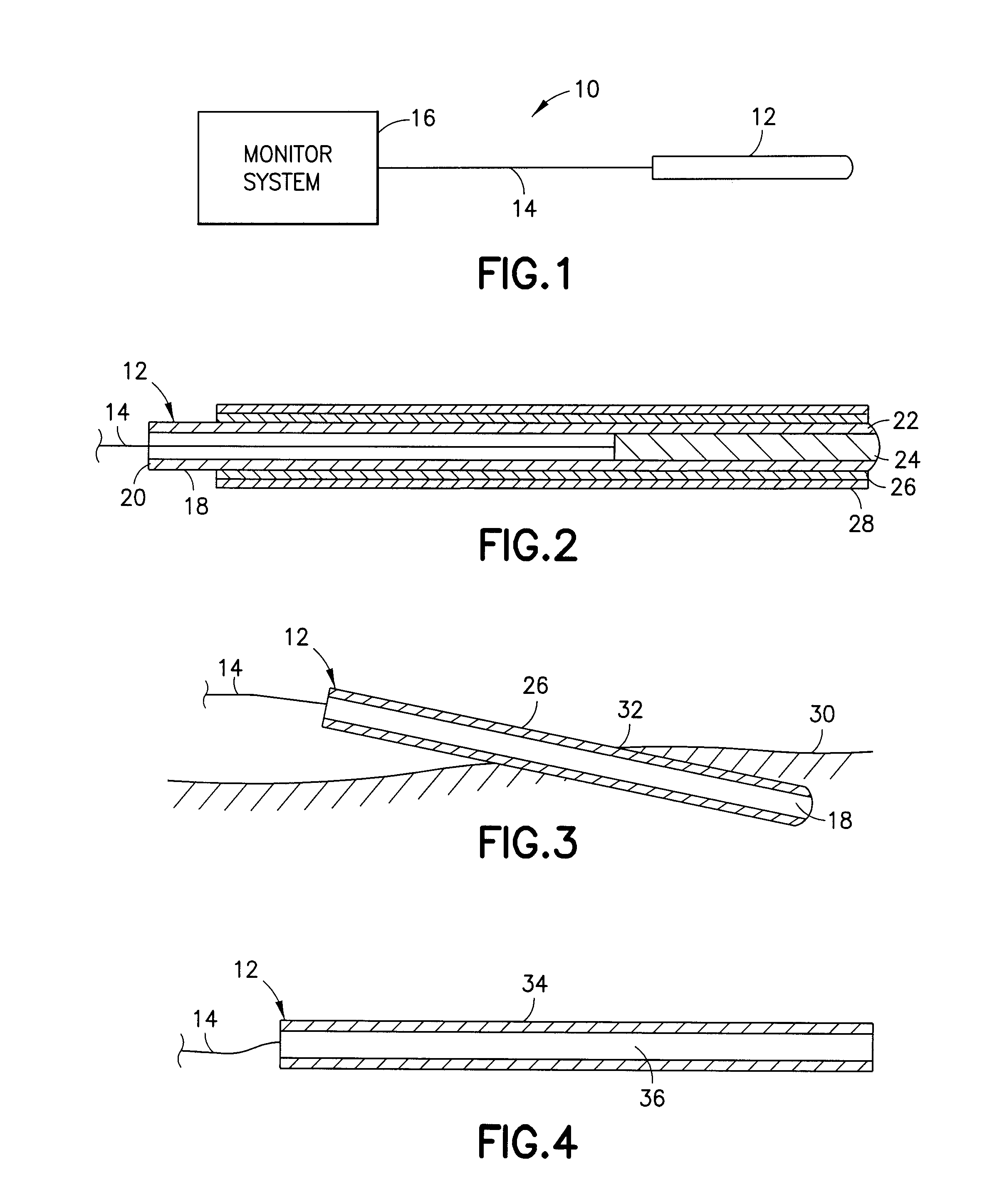 Device and Method for Inhibiting Movement of a Medical Device in a Patient