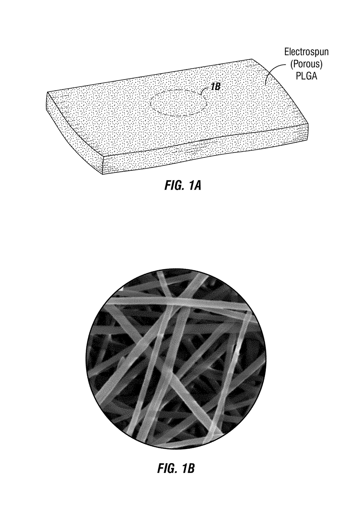 Implantable electrospun patches for site-directed drug delivery