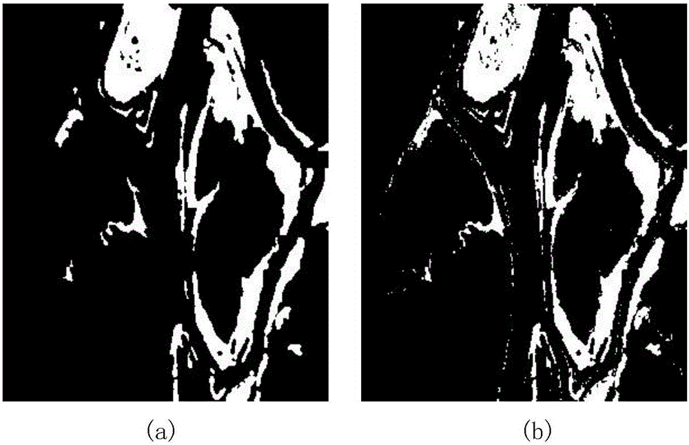 NMF image fusion-based SAR image change detection method