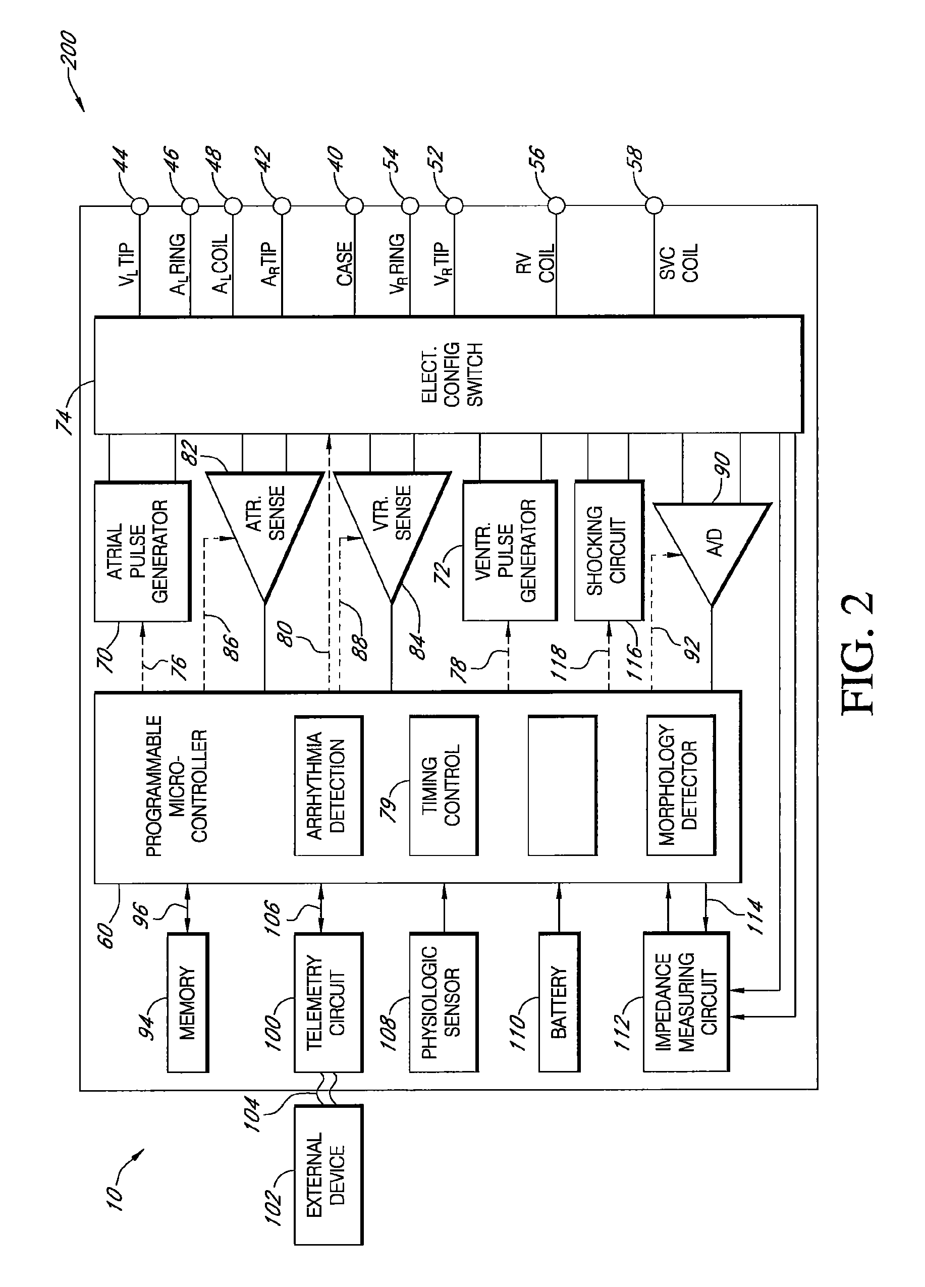 Closed loop programming for individual adjustment of electro-mechanical synchrony
