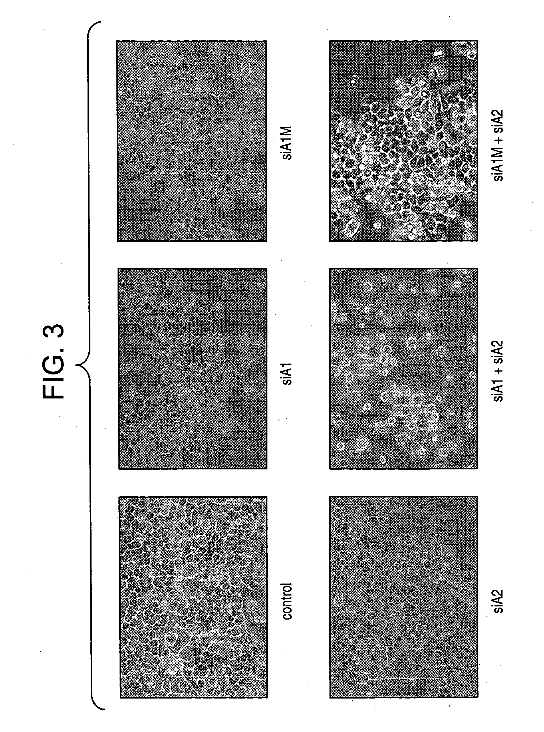 Methods and compositions relating to hnRNP A1, A1B, A2, and B1 nucleic acid molecules