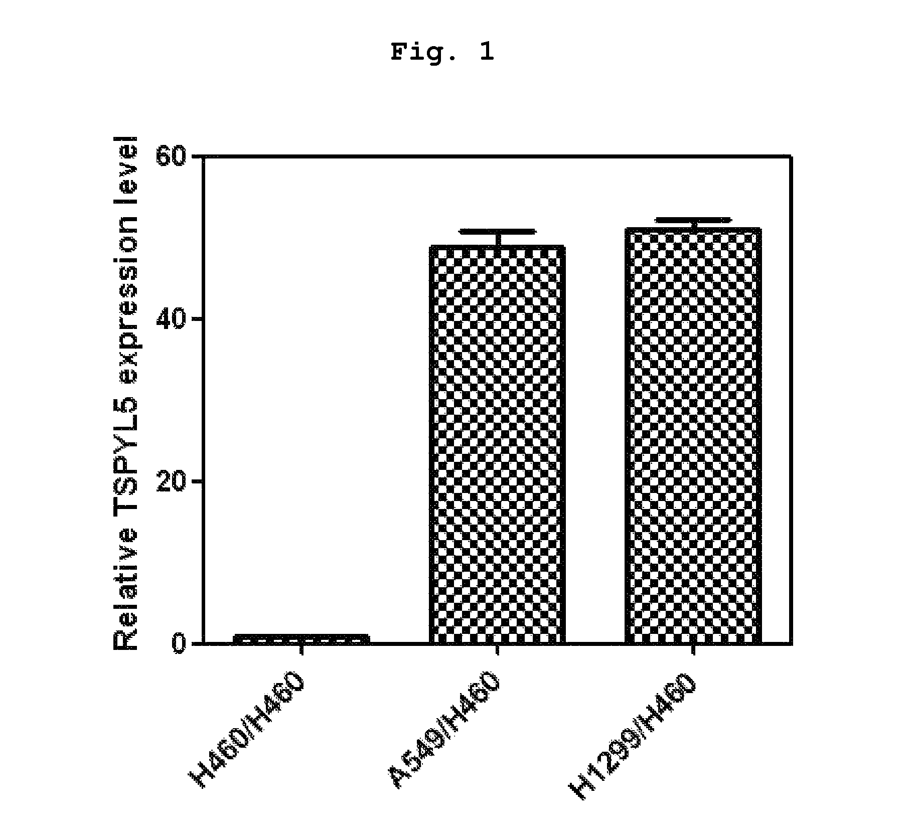 Method for enhancing chemical sensitivity or radiosensitivity of cancer cells by inhibiting expression of TSPYL5