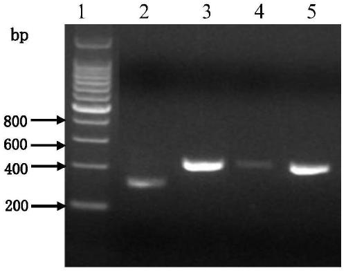 Anti-human tissue kallikrein 1 antibody and its application