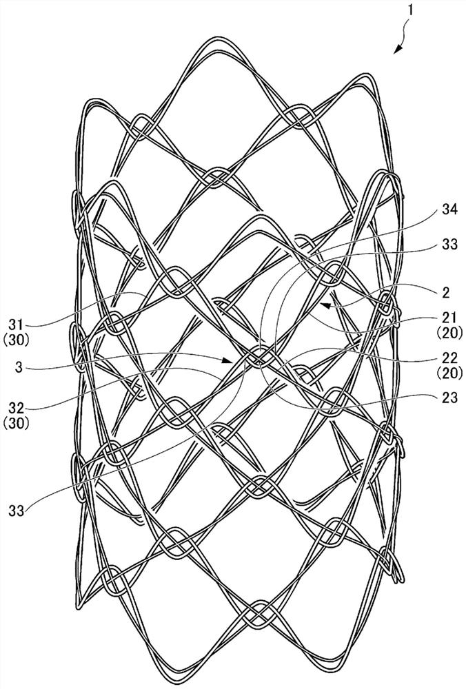 Synthetic resin stent