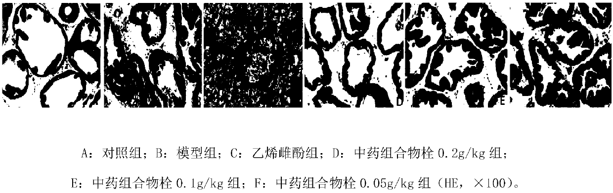 Traditional Chinese medicine composition for treating prostatitis and preparation method thereof