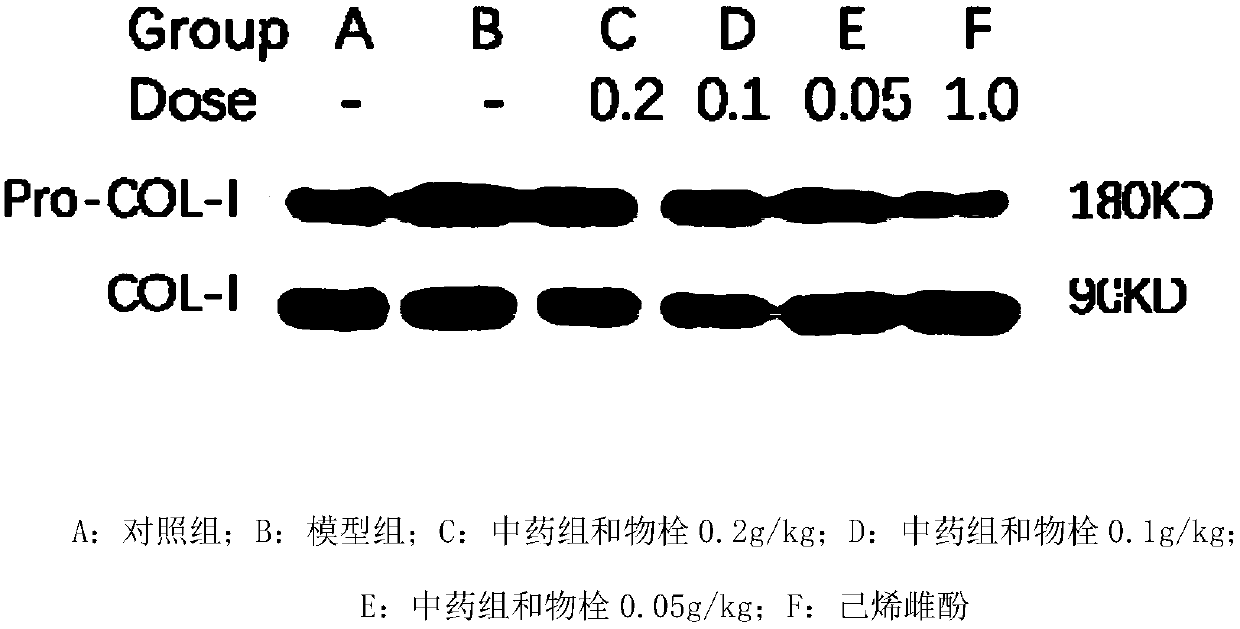Traditional Chinese medicine composition for treating prostatitis and preparation method thereof