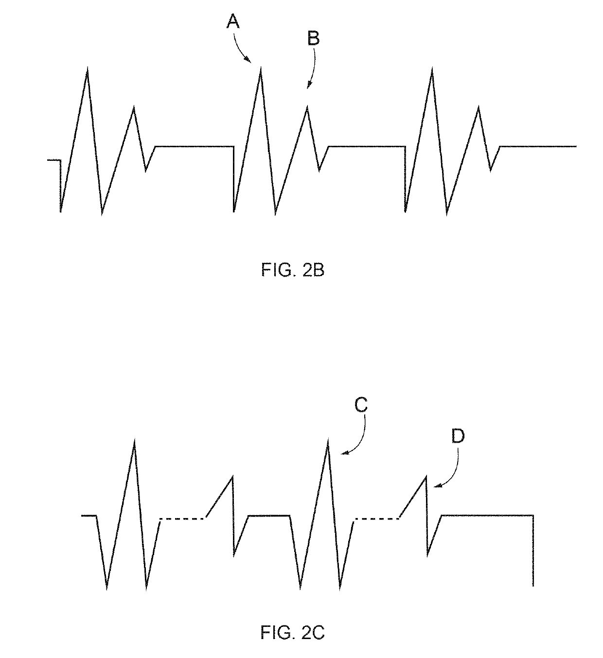 Devices AMD methods for brain stimulation