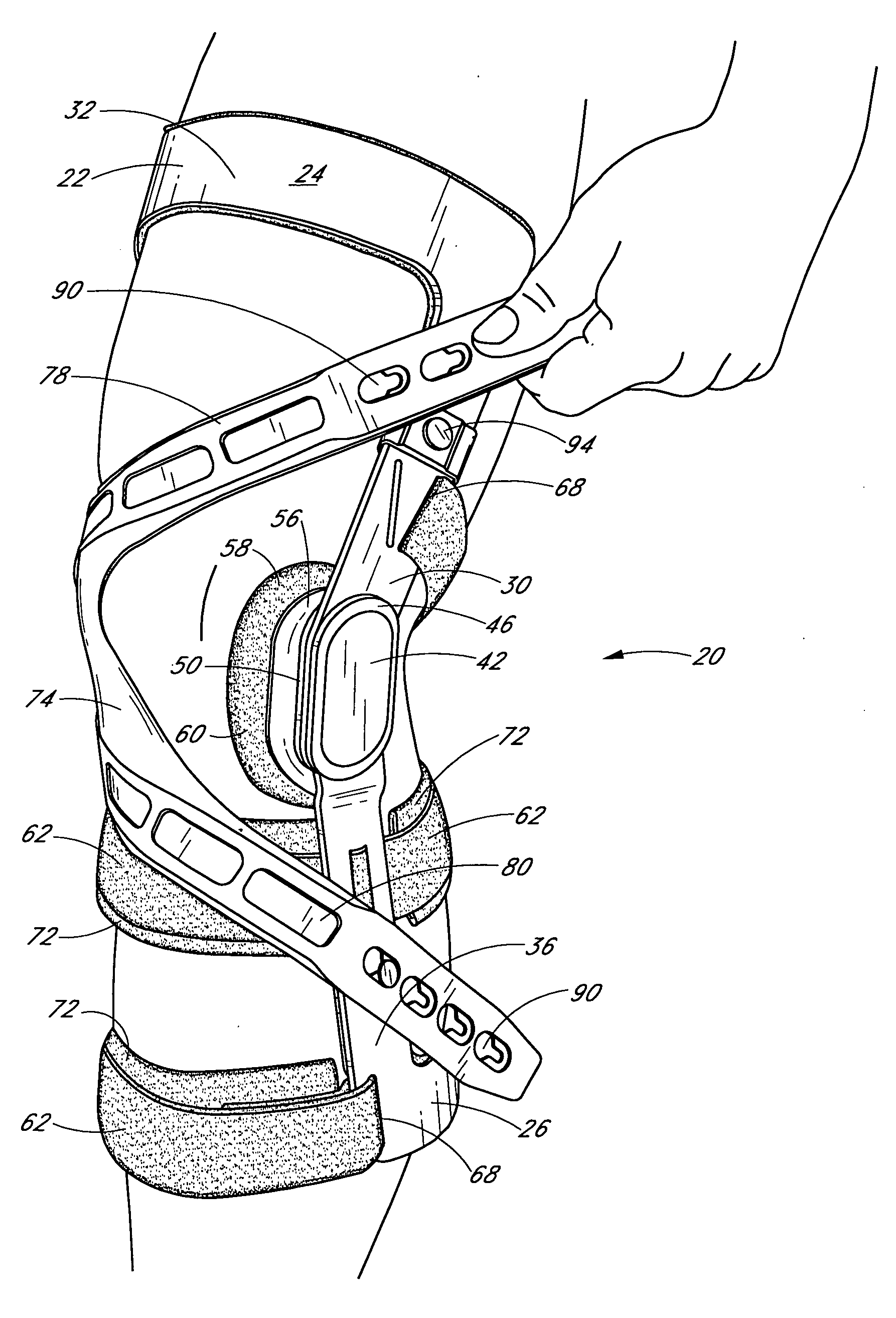Knee brace having a rigid frame and patellofemoral support