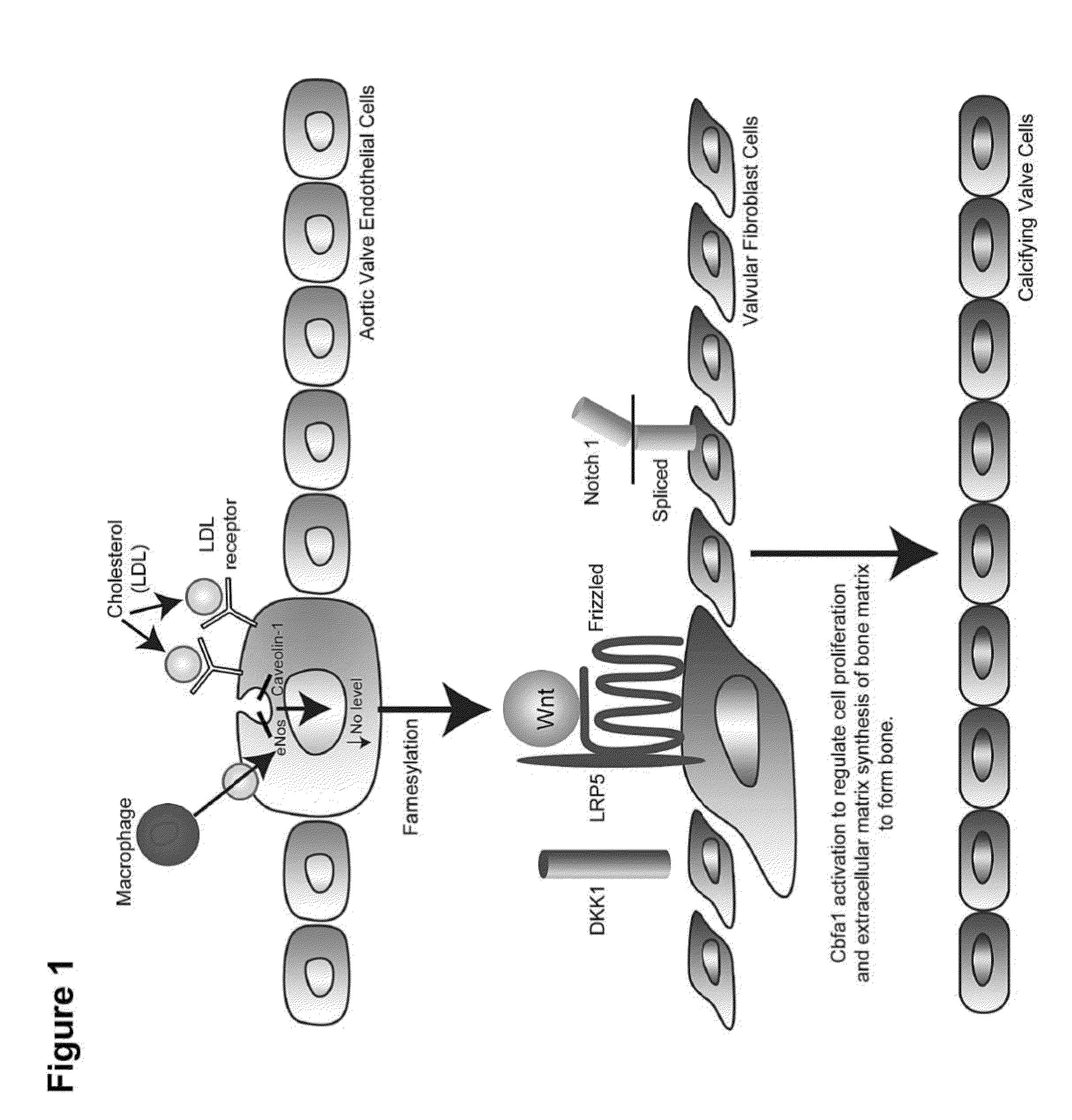 Devices and methods for inhibiting stenosis, obstruction, or calcification of a native heart valve, stented heart valve or bioprosthesis