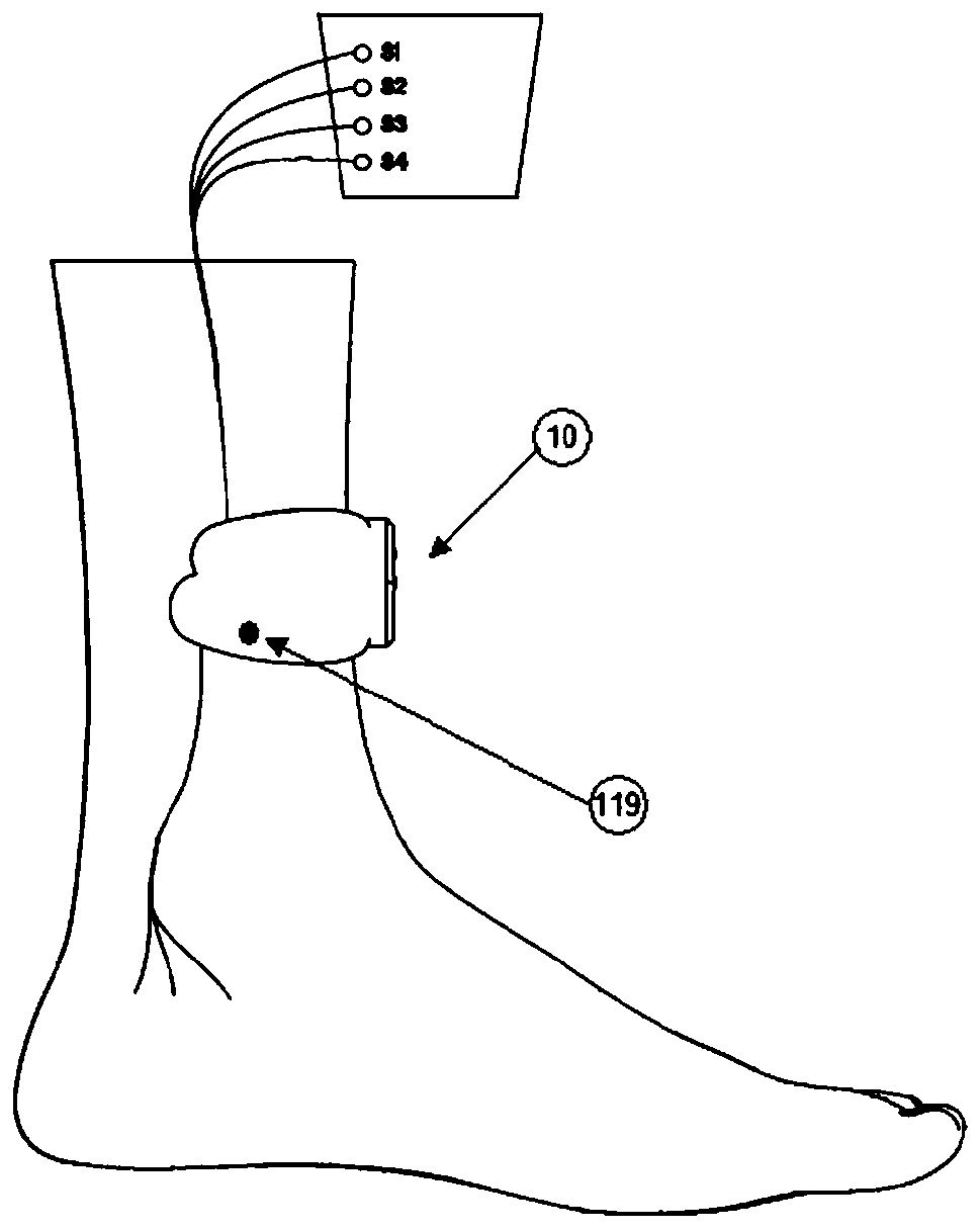 Wearable wireless intelligent posterior tibial nerve electrical stimulation system