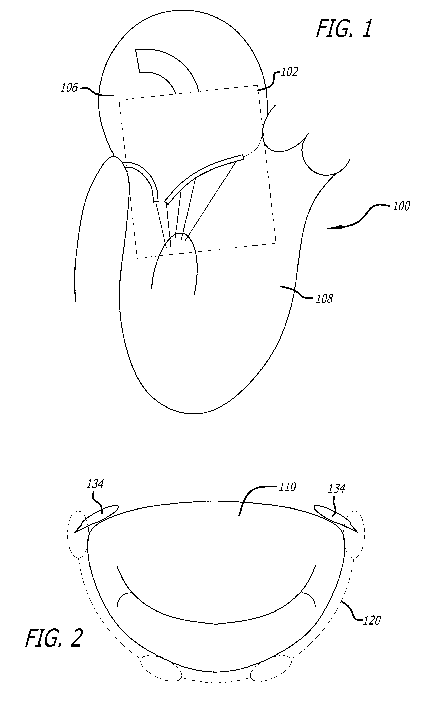 Methods and systems for heart valve therapy