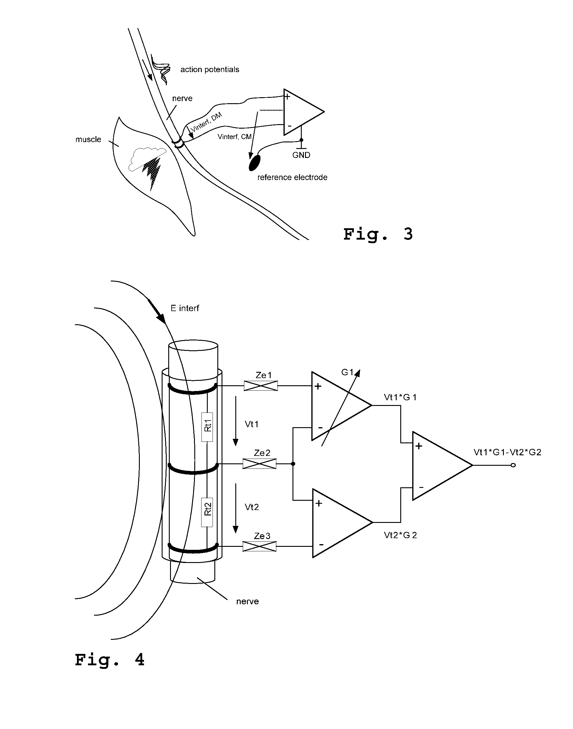 System for recording electroneurographic activity