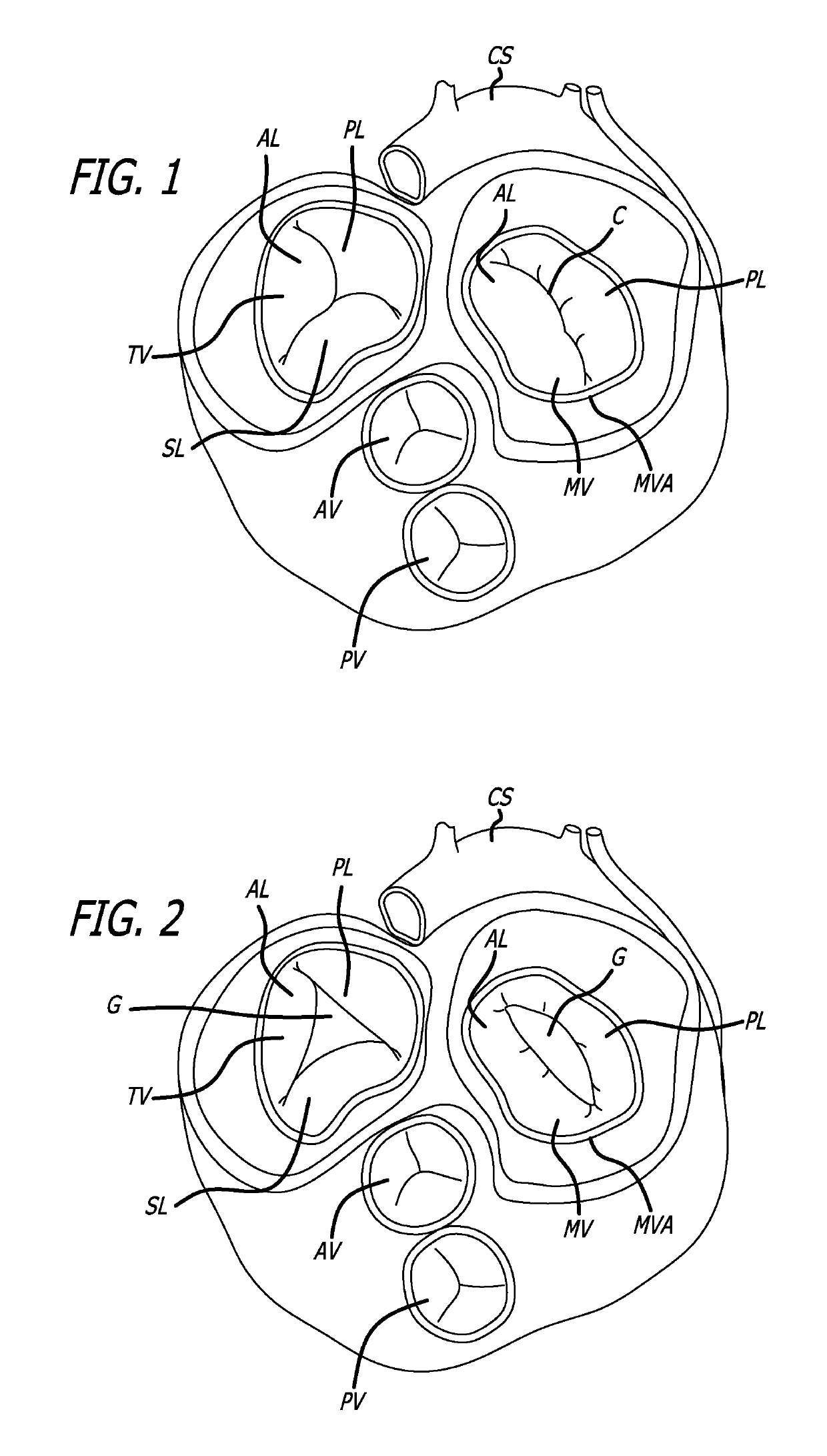 Fixation devices, systems and methods for heart valve leaf repair