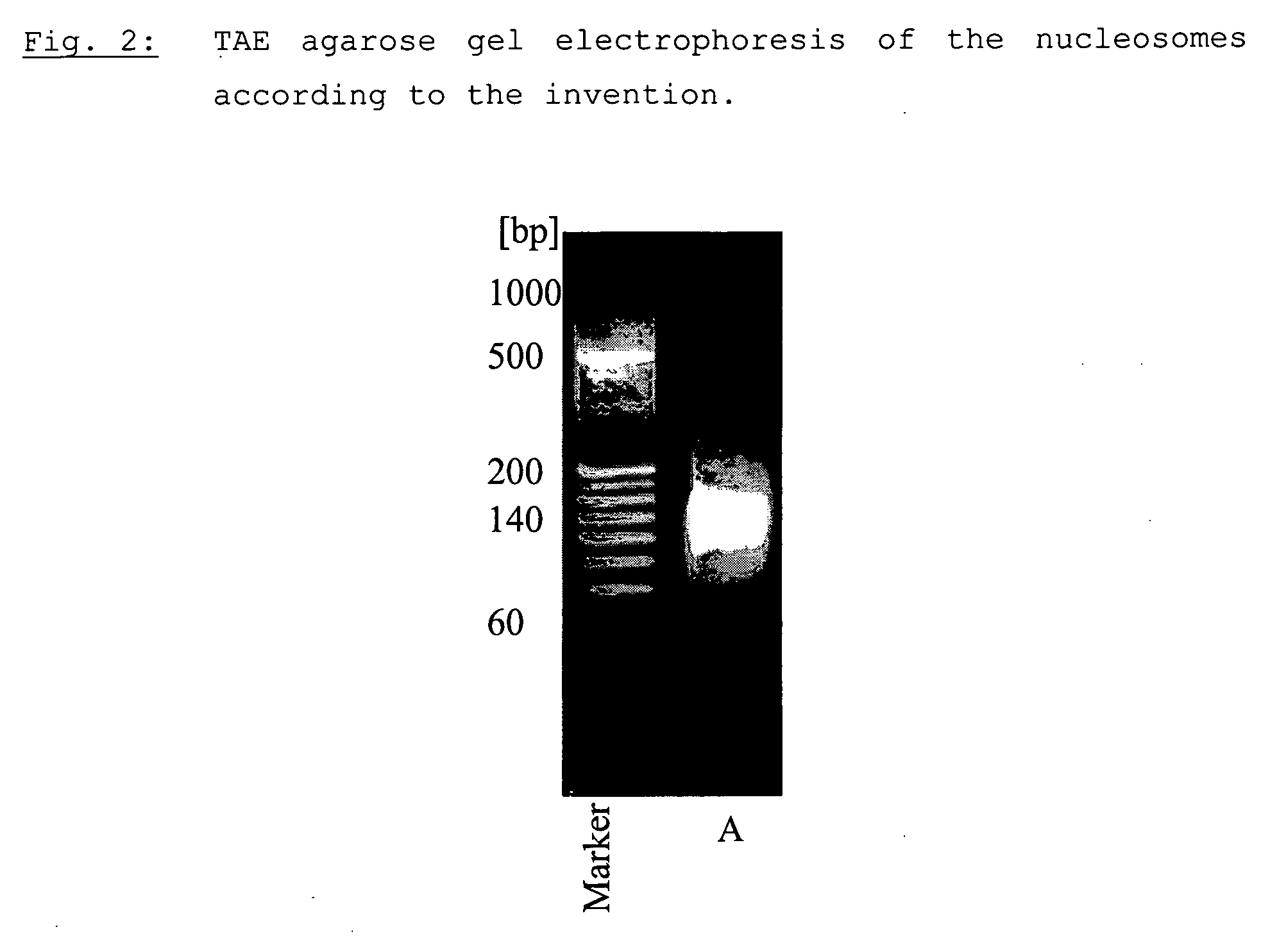 Method for producing a nucleosome preparation and use thereof in in vitro diagnosis of disseminated lupus erythematosus (dle)
