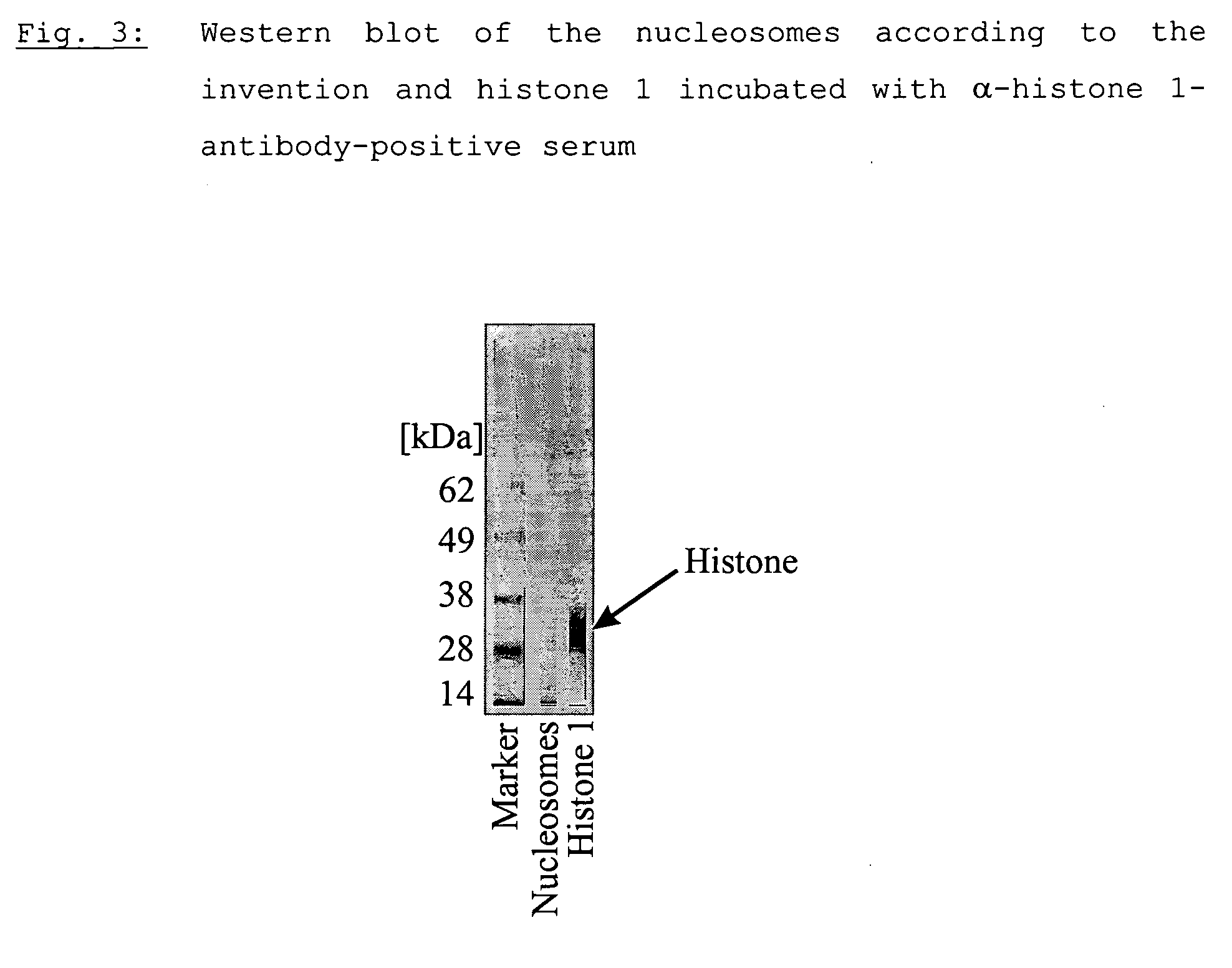 Method for producing a nucleosome preparation and use thereof in in vitro diagnosis of disseminated lupus erythematosus (dle)