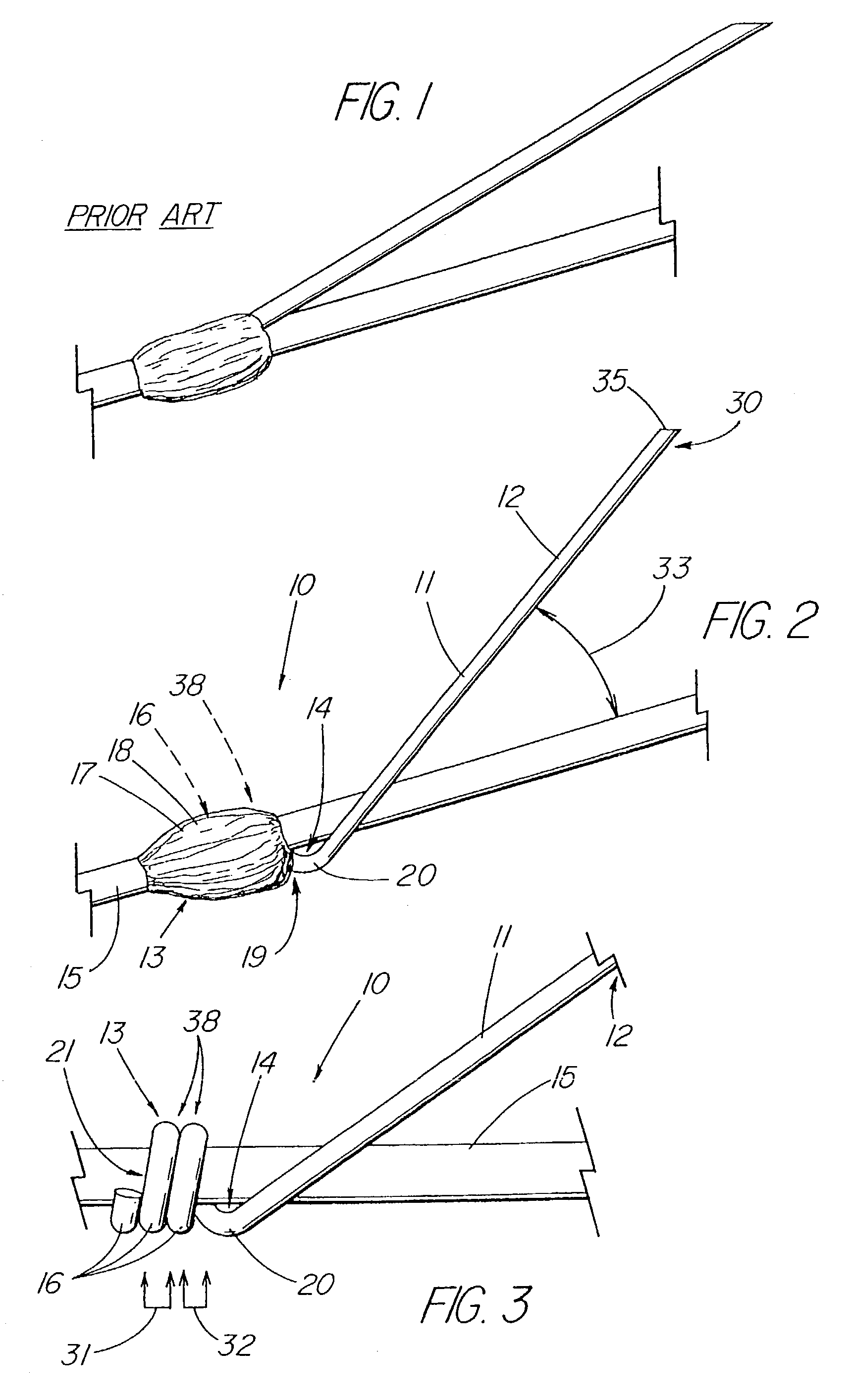 Flexible barb for anchoring a prosthesis